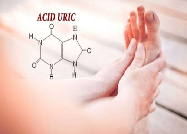 <center><em>Thông tin tham khảo chỉ số acid uric bao nhiêu thì bị gout</em></center>